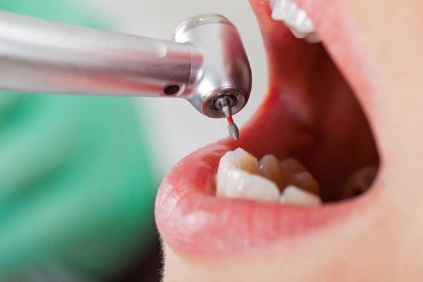 Best Emergency Dental Surgery in Bawcomville, LA